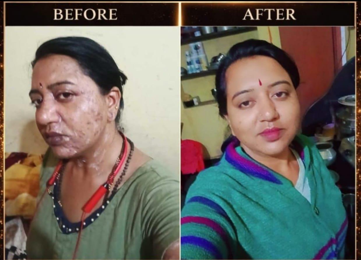 Skin Result