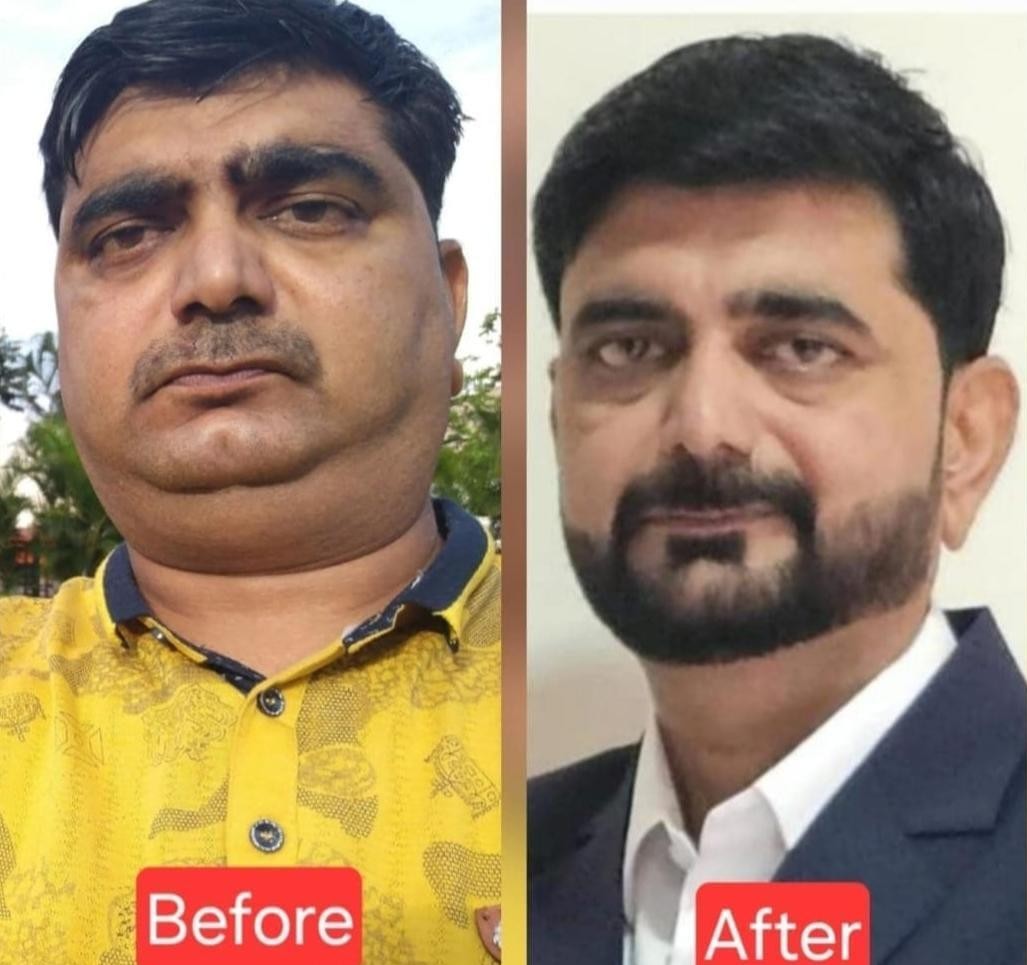 Weight Loss Result
